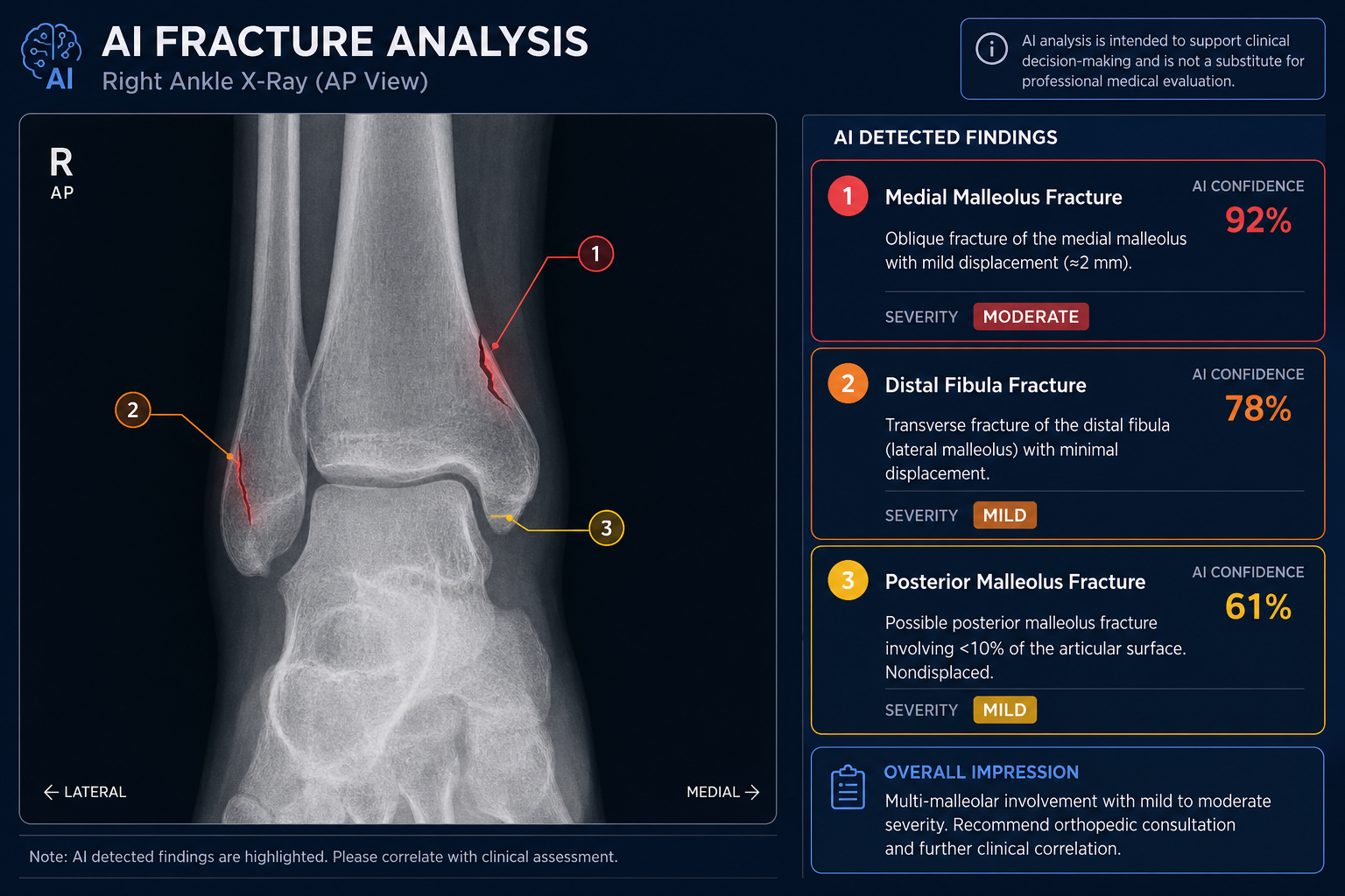 AI-Enhanced Fracture Detection
